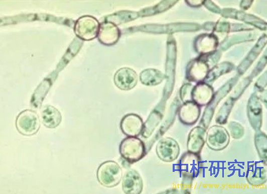 白色念珠菌檢測